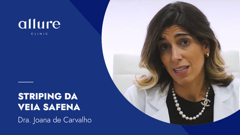 Saphenous vein striping - video by Dr. Joana de Carvalho