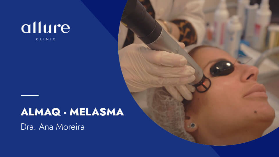 AlmaQ - Melçasna na face - Allure Clinic