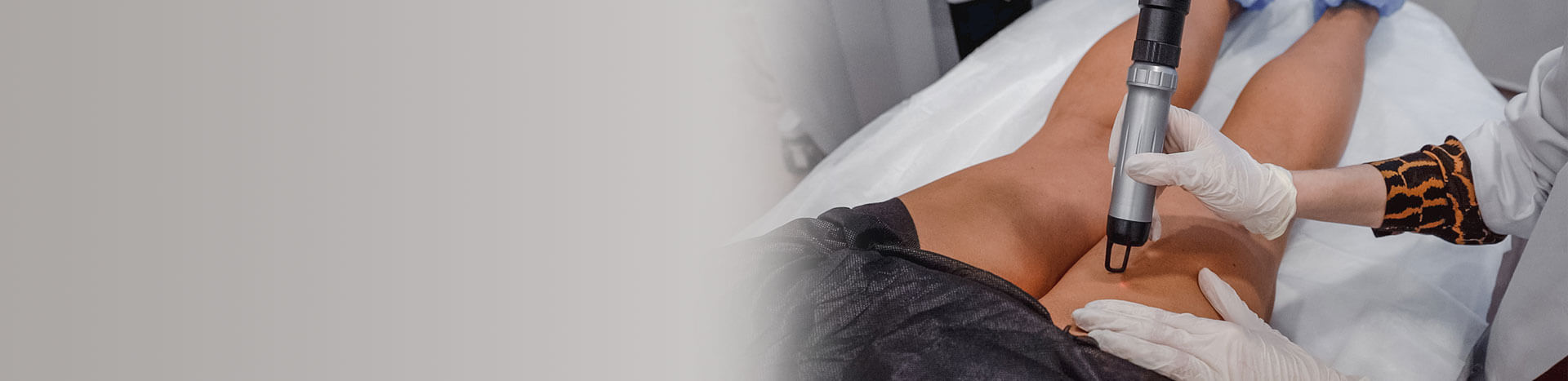 tratamentos laser para as suas pernas no Porto